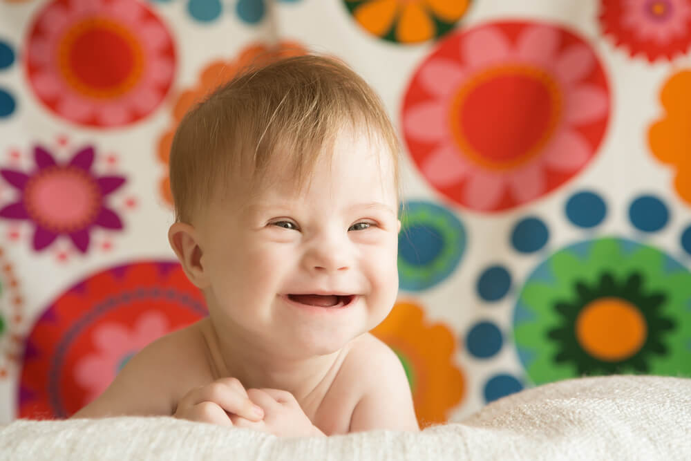 young child with Down syndrome smiles