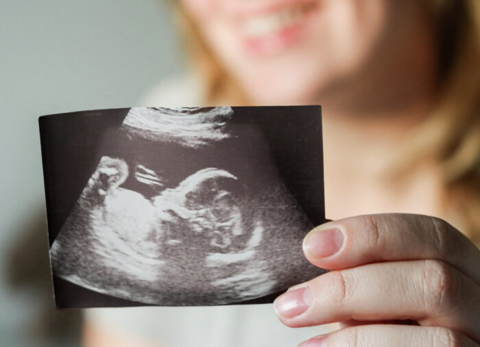 A Miraculous Pregnancy from the Walk to Mary (Family Rosary Across America)