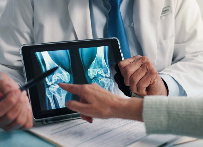 Strong Muscles, Strong Bones: Why Bone Loss Isn’t Just an Over-50 Story (Trending with Timmerie) Strong Muscles, Strong Bones: Why Bone Loss Isn’t Just an Over-50 Story (Trending with Timmerie)